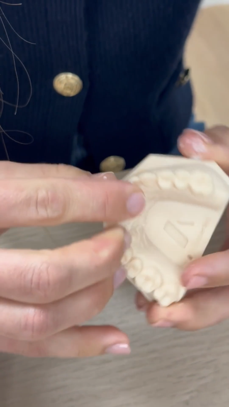 Curso implantes - Clase 2